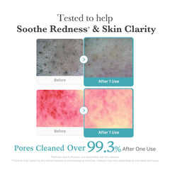 Medicube after-spot care context shows cleanser supporting pore refinement.
