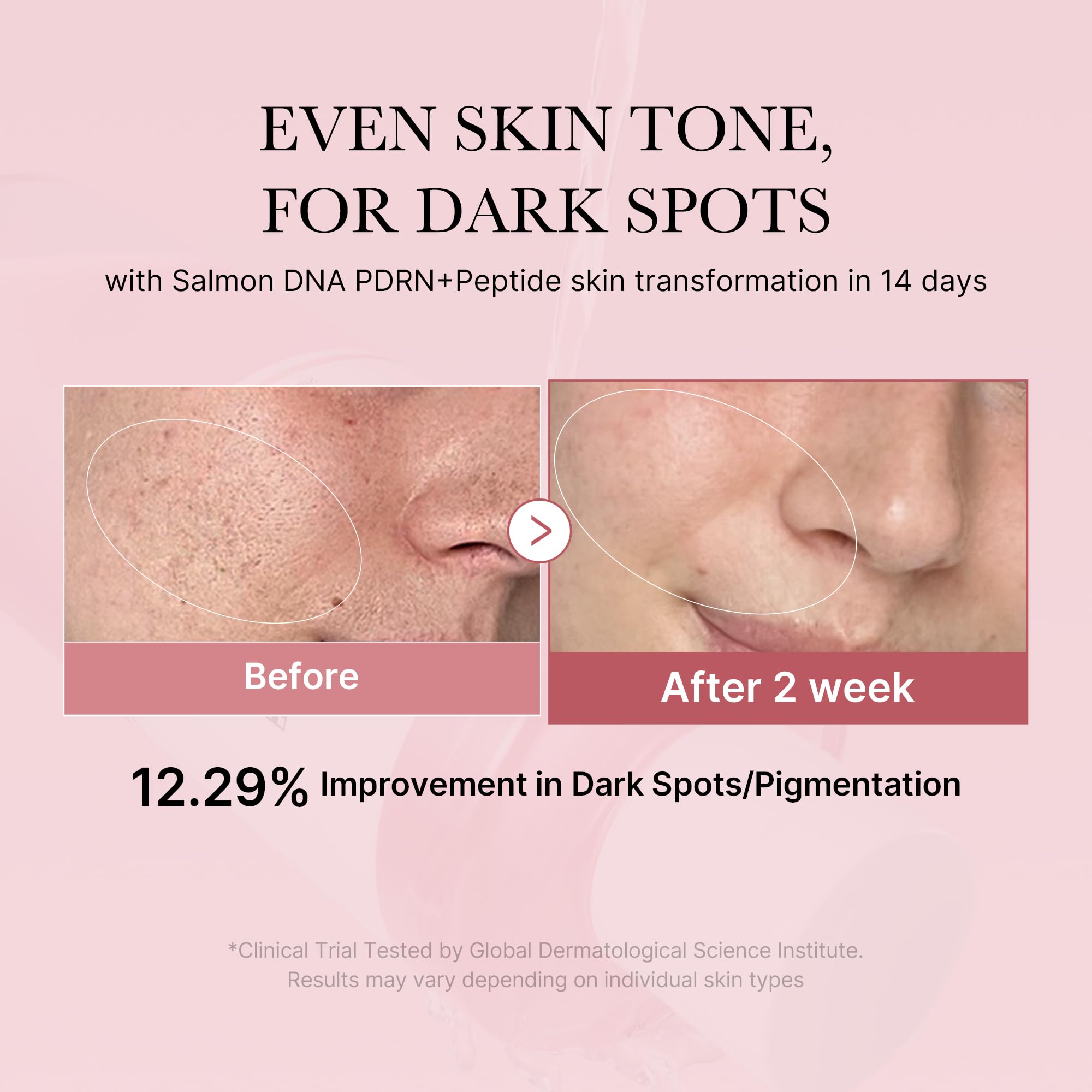 Medicube Pink Glow Toner being applied to cheek for radiance