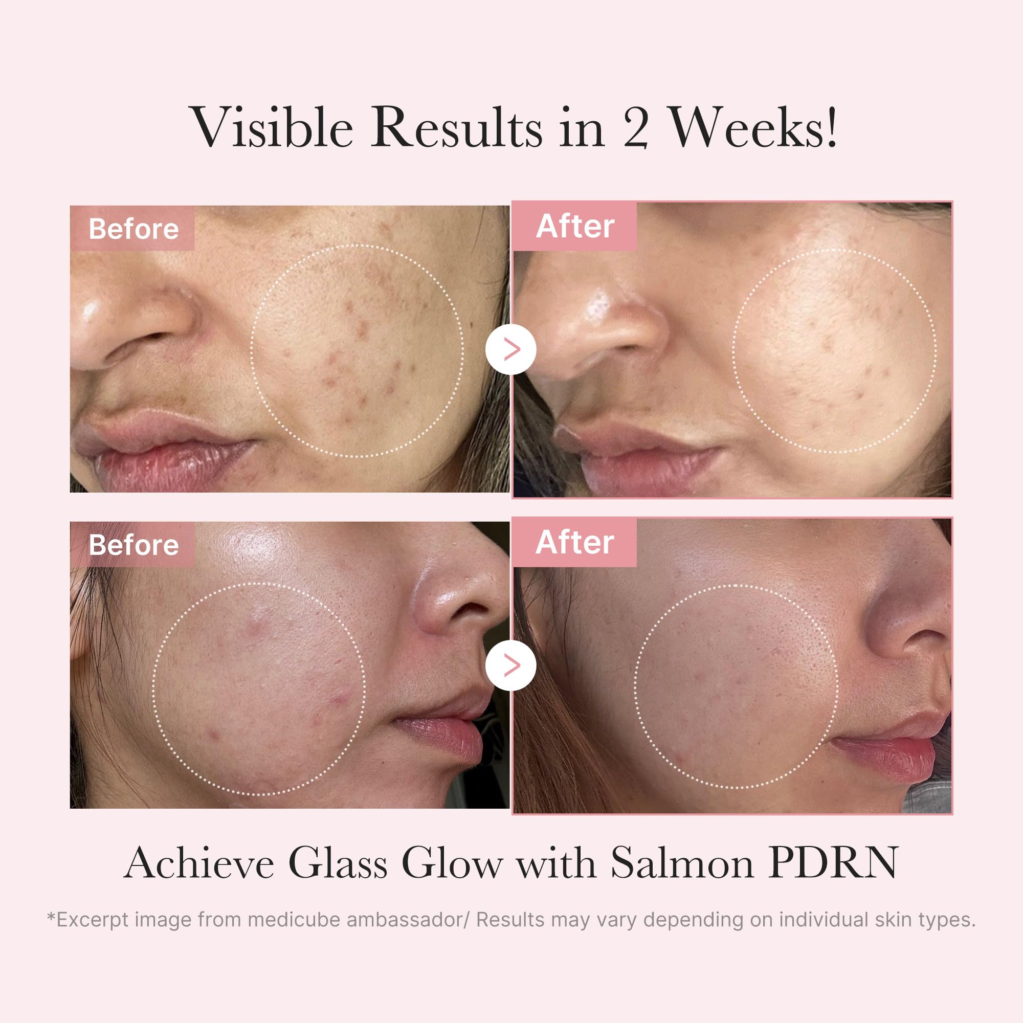 Medicube Salmon DNA PDRN Trial Kit ampoule for concentrated nourishment and skin renewal