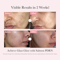 Medicube Salmon DNA PDRN Trial Kit ampoule for concentrated nourishment and skin renewal
