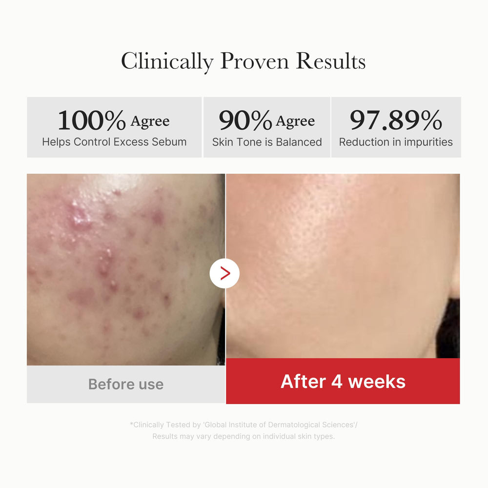 Medicube Toner Pads being applied from bottle to face with pads