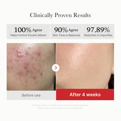 Medicube Toner Pads being applied from bottle to face with pads