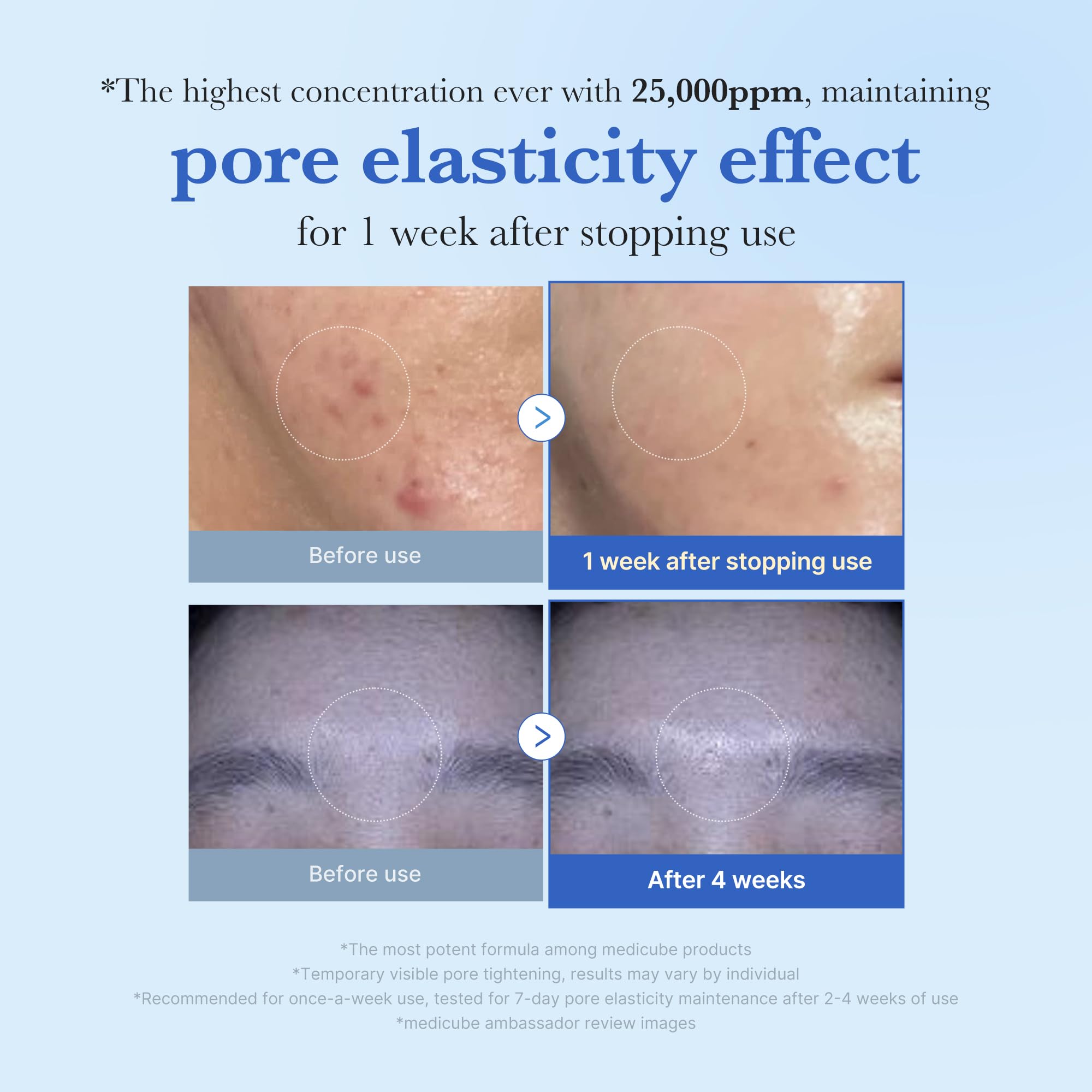 Medicube Zero Exosome Shot spicule close-up targets smoother texture.