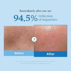 Medicube Zero Pore Cleansing Oil emulsifies to a milky finish for a light cleanse