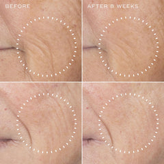 Medik8 Liquid Peptides Advanced MP serum applied on face during routine