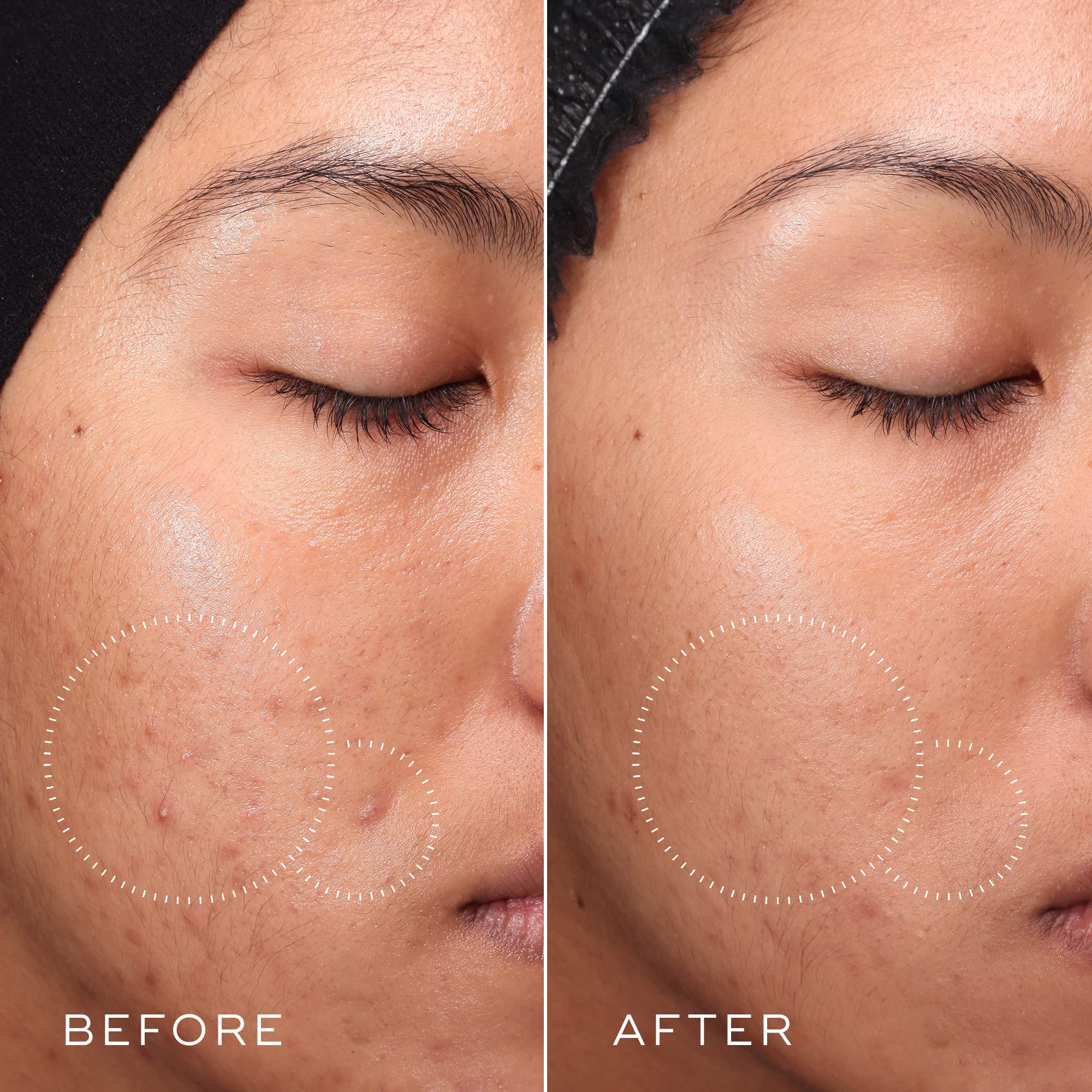 Medik8 Press and Clear bottle label for sensitive skin consumers.