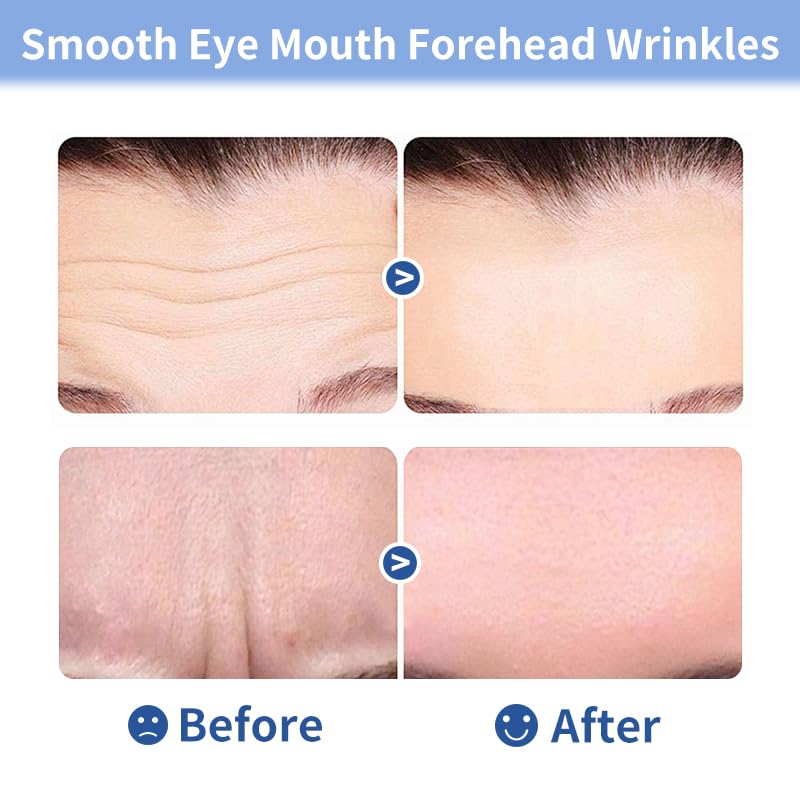Medimama collagen-boost formula targets forehead wrinkles and frown lines.