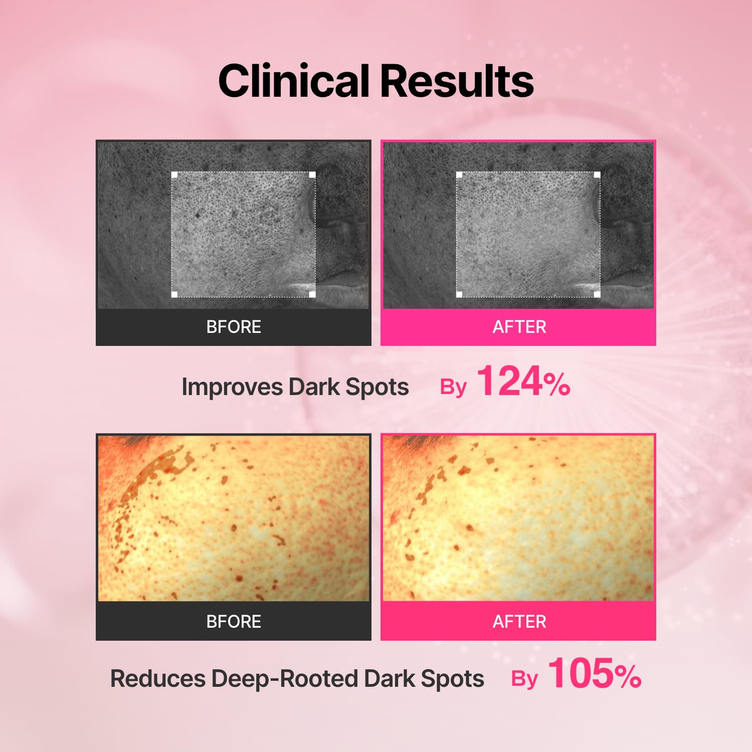MEDITHERAPY 5% Niacinamide 3% TXA blend improves clarity and tone