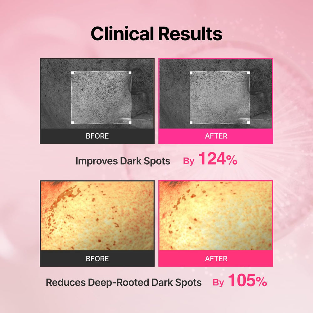 MEDITHERAPY 5% Niacinamide 3% TXA blend improves clarity and tone