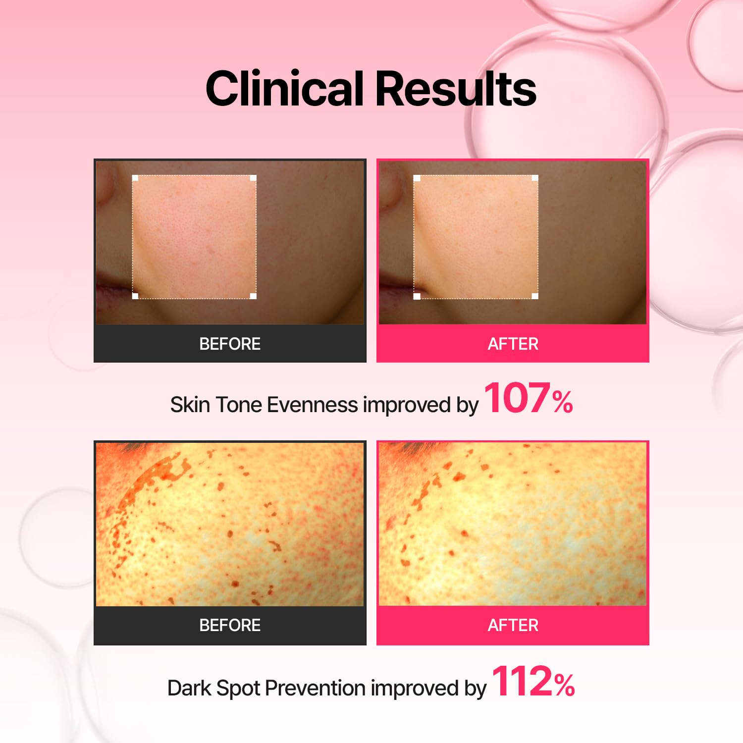 MEDITHERAPY Arbutin Serum detachable cap enables refill-friendly skincare.