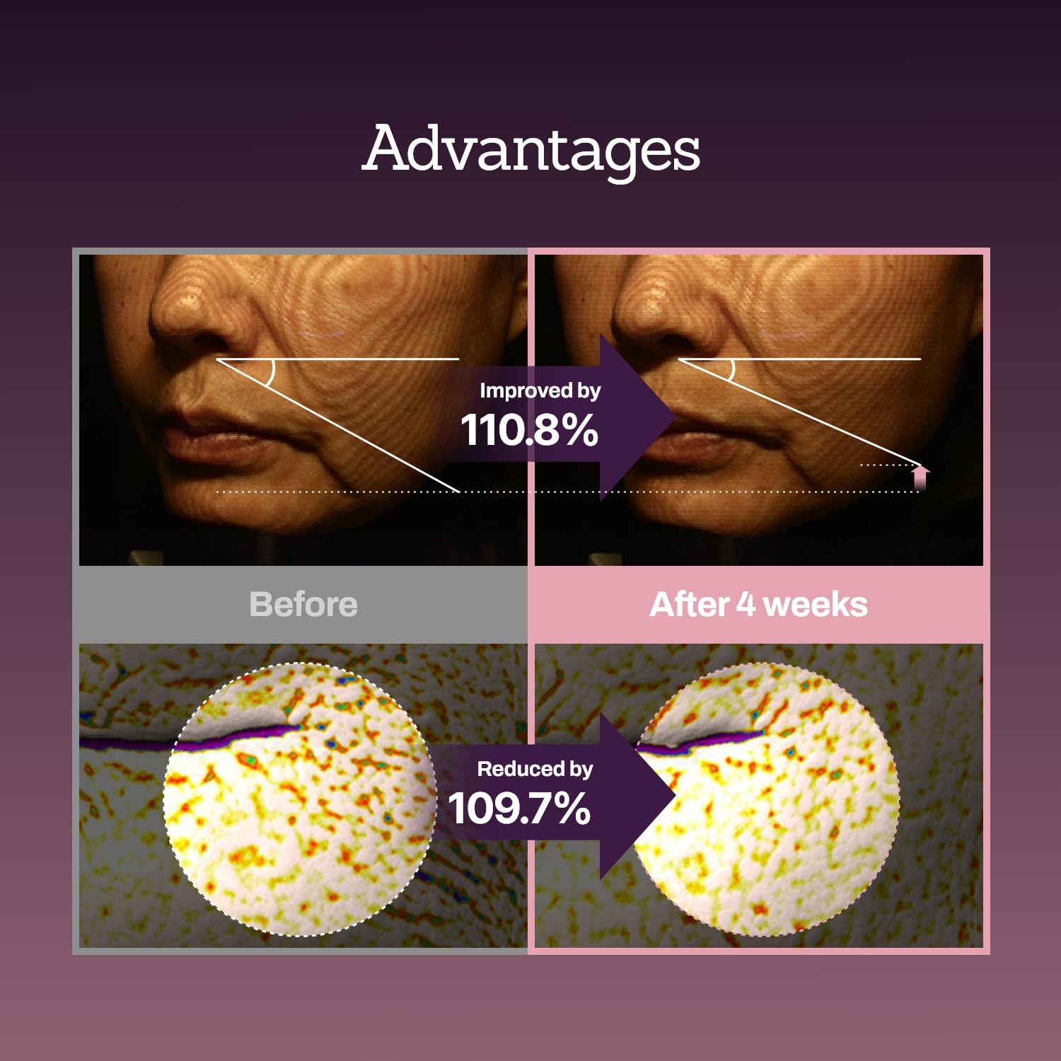 Soft-focus image suggesting improved elasticity and smoother texture after use.