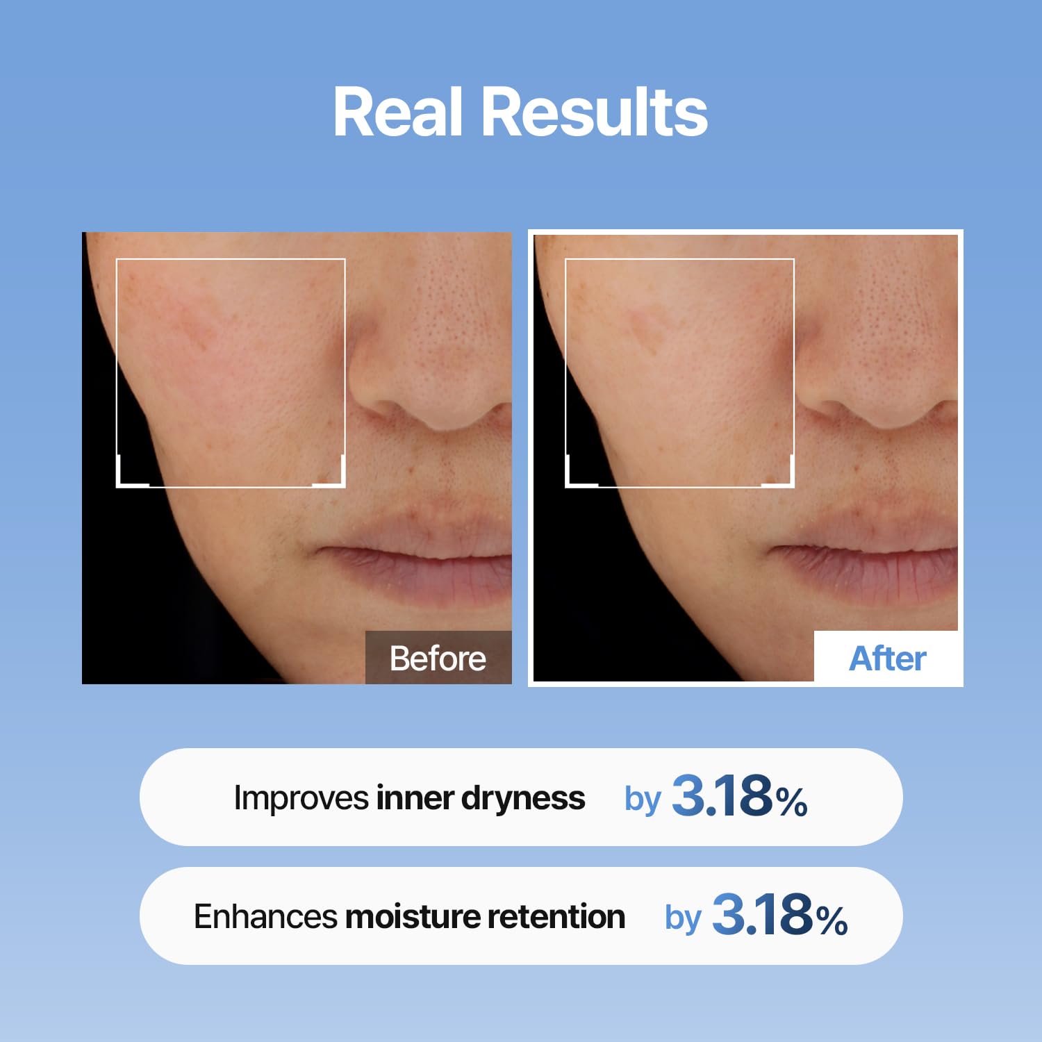 Meditherapy serum applied on cheek for smooth base.