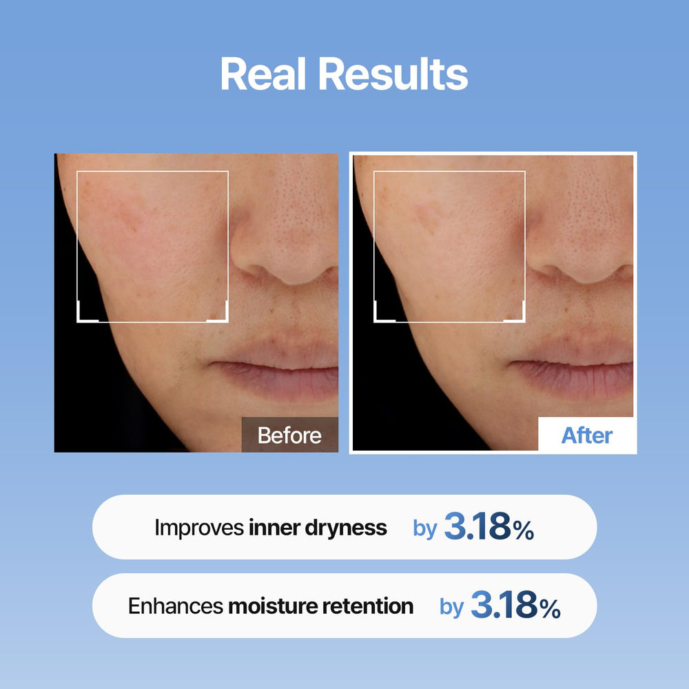 Meditherapy serum applied on cheek for smooth base.
