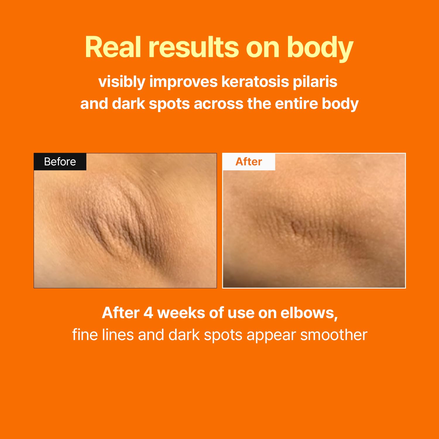 MEDITHERAPY Retinal Serum targets pores on blemish-prone skin.