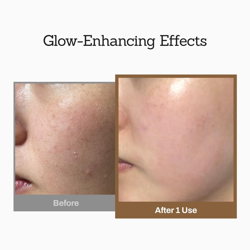 MEDITHERAPY Rice Wash-Off Mask rinse close-up reveals clean removal and refreshed skin
