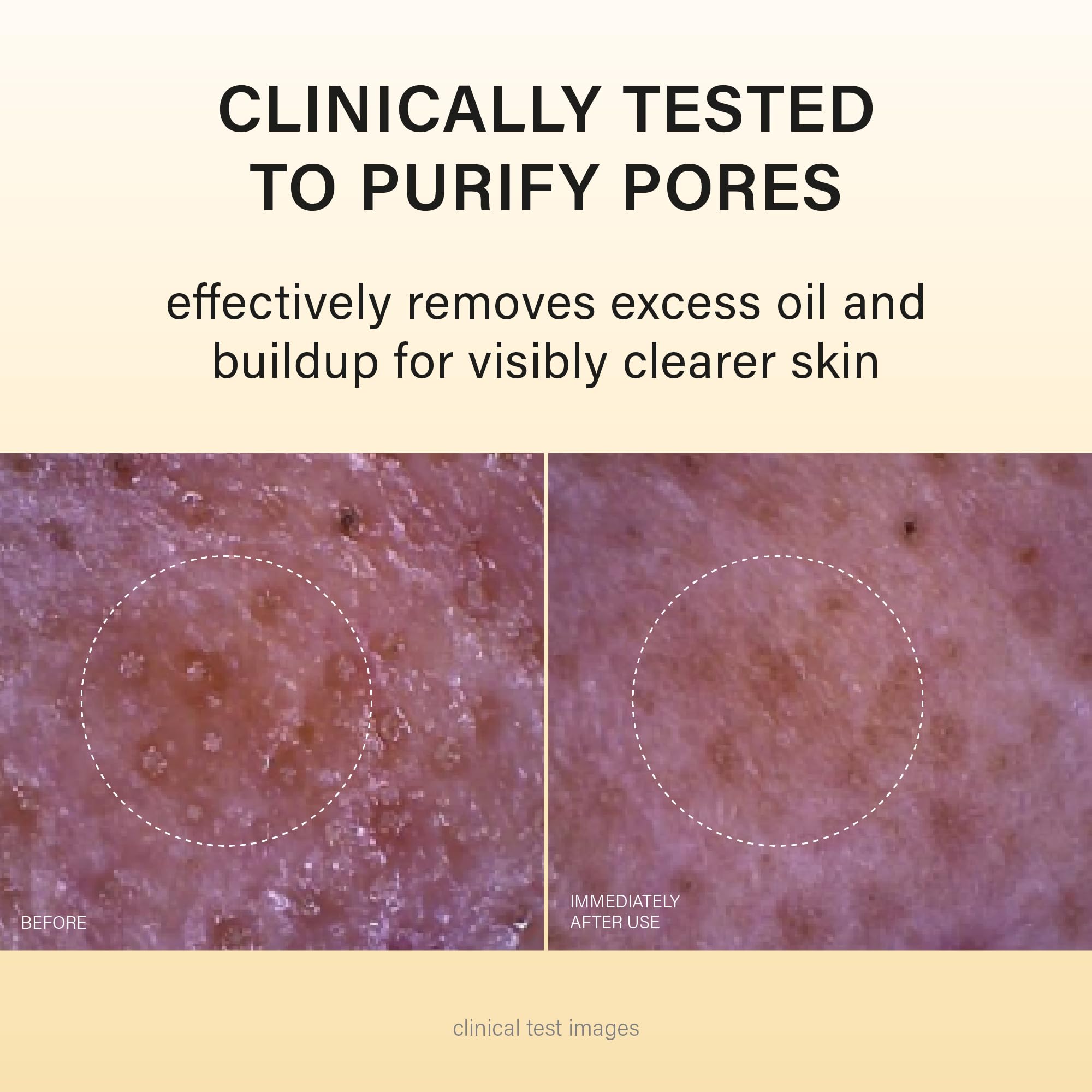 Melixir removes SPF and excess oil while preserving moisture.