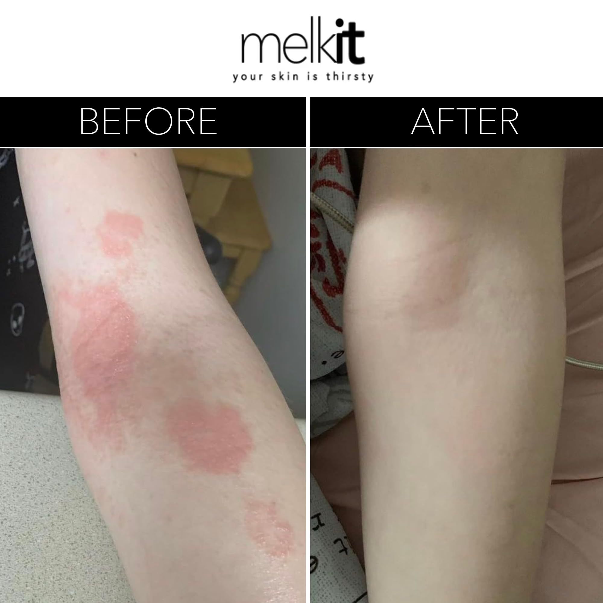 Melkit Bodymelk cream hand application demonstrates easy rub-in for daily use.