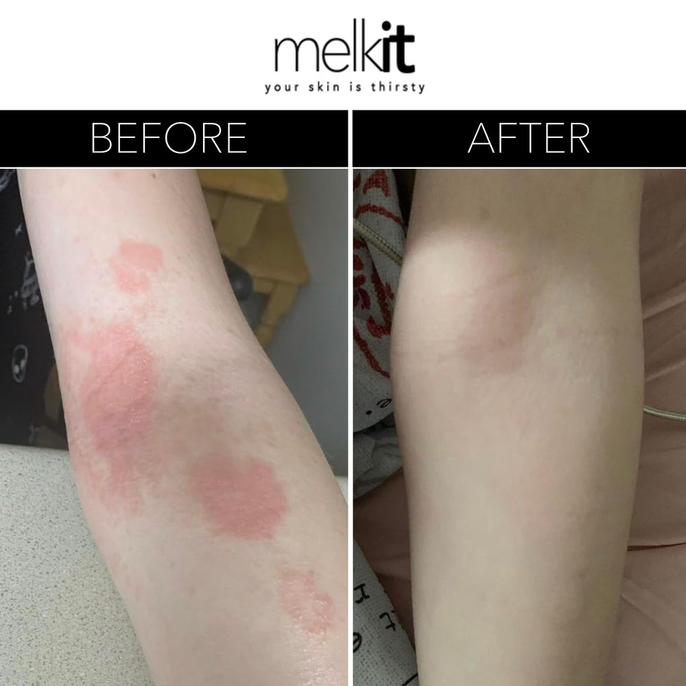 Melkit Bodymelk cream hand application demonstrates easy rub-in for daily use.