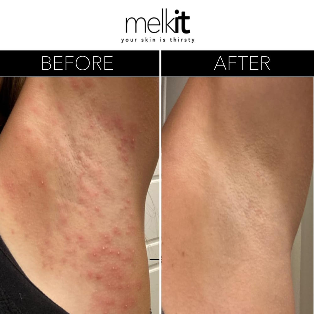Melkit Bodymelk cream texture swirls indicate fast absorption and non-greasy feel.