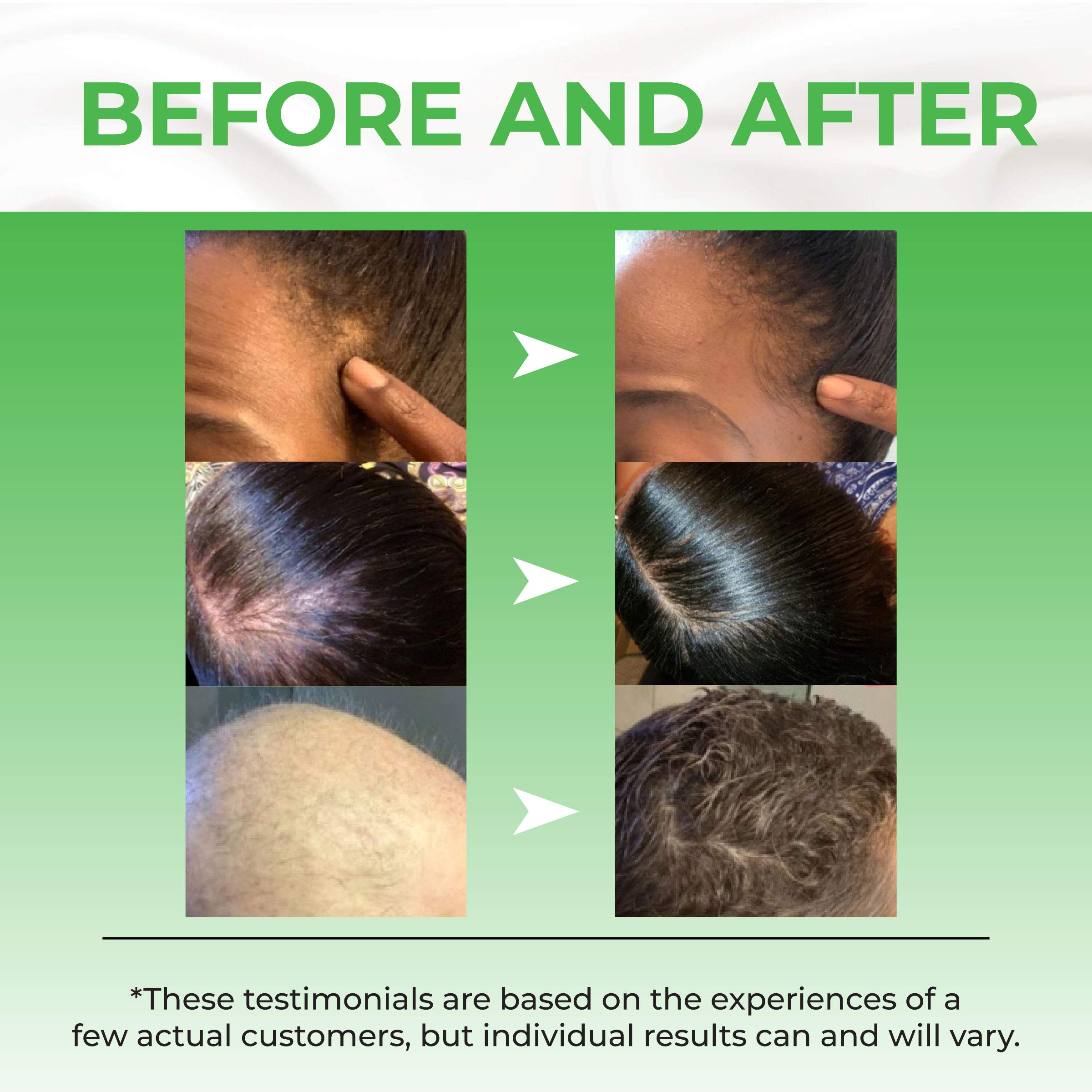 Meraz Pureauty Naturals serum close-up shows clear, non-sticky formula.