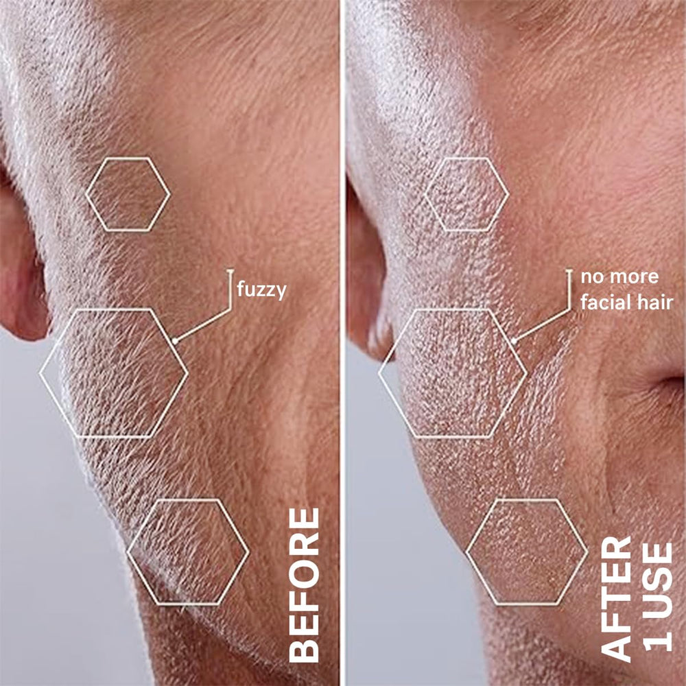 MICHAEL TODD Sonicsmooth Pro+ USB rechargeable battery for cordless use