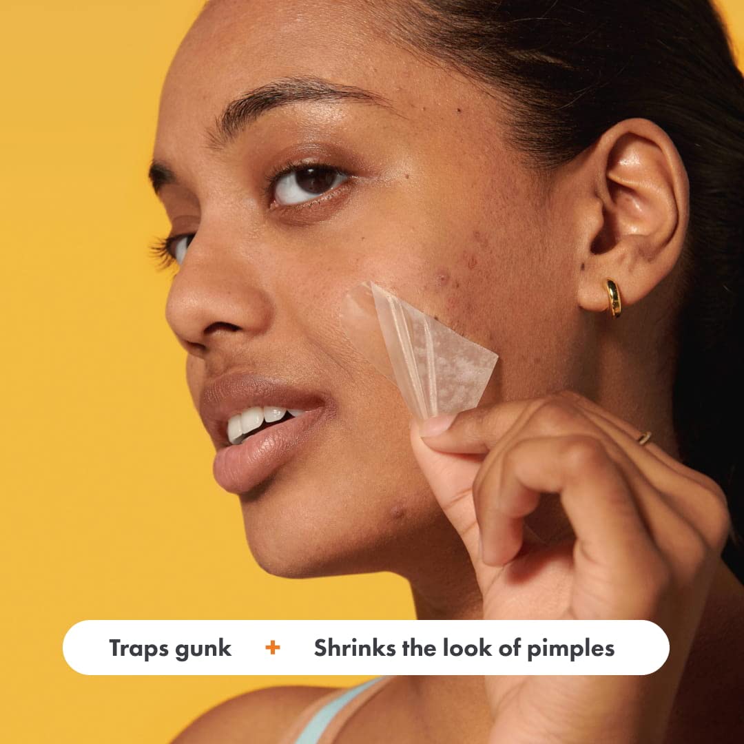 Mighty Patch Face XL patch on the chin helps reduce pimple visibility overnight.