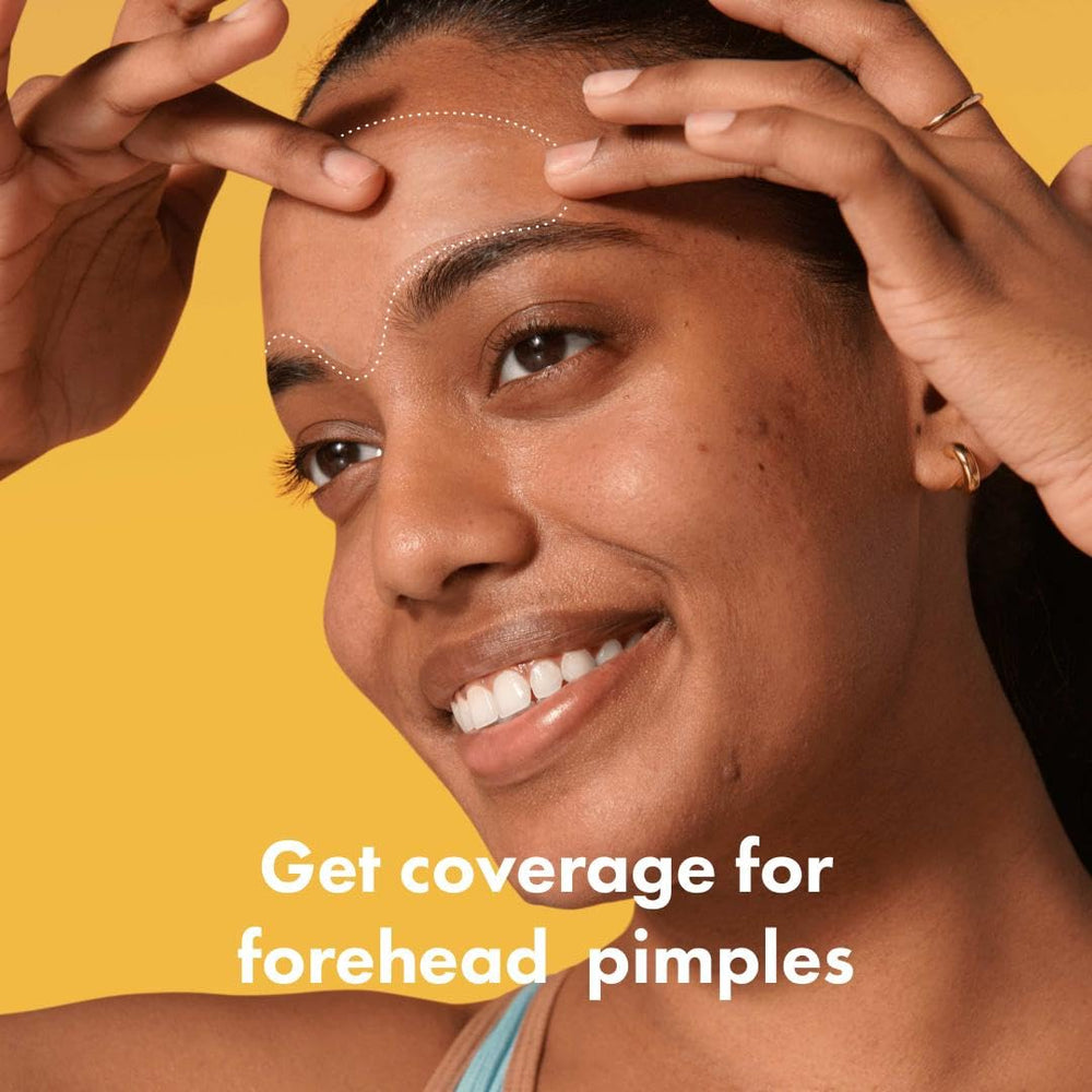 Mighty Patch forehead patch on forehead demonstrates contour fit for seamless coverage.