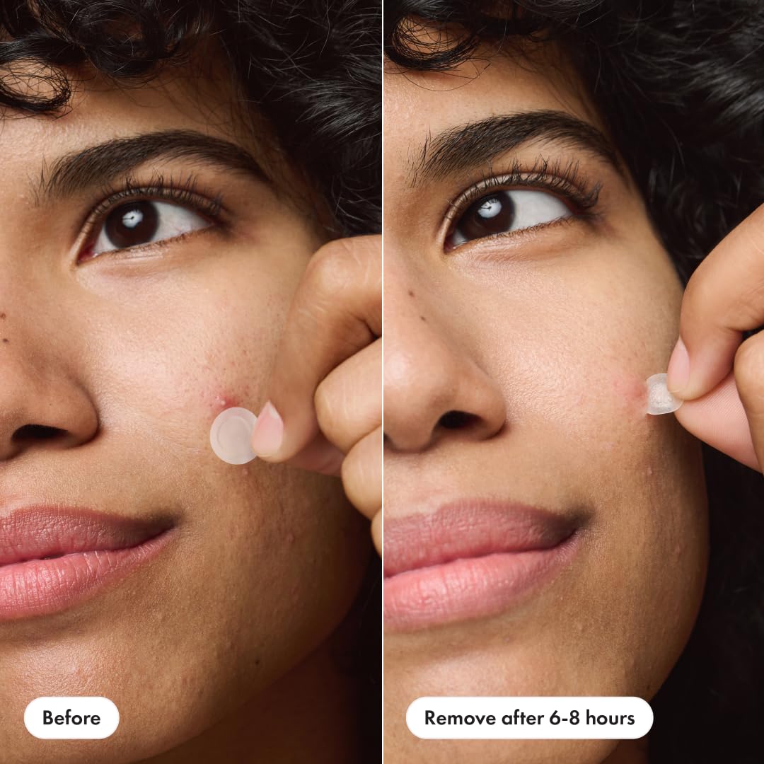 Mighty Patch Invisible+ strong adhesive keeps zit secure during daily activities