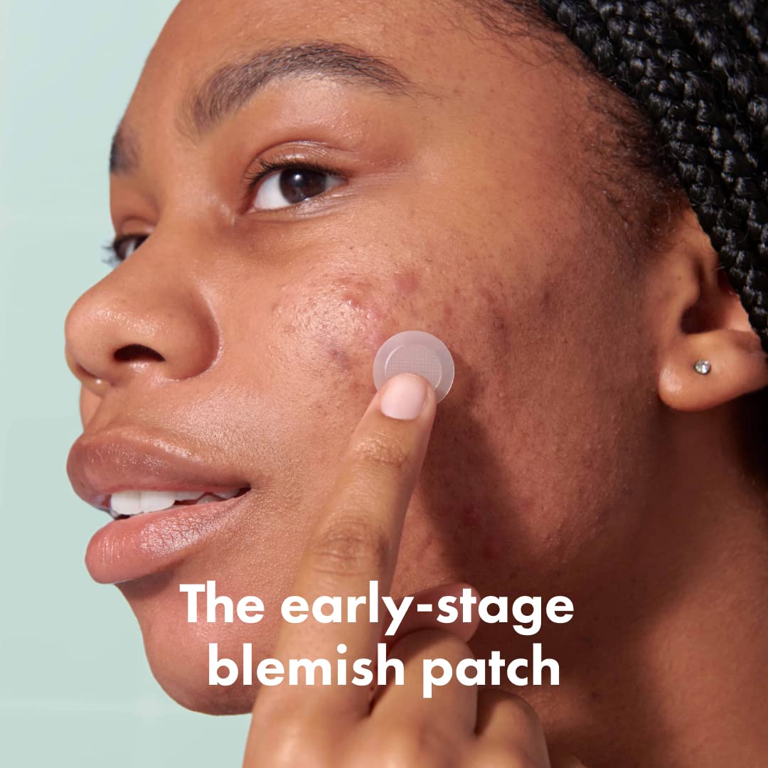 Mighty Patch Micropoint Large patch applied to a blemish for targeted spot treatment