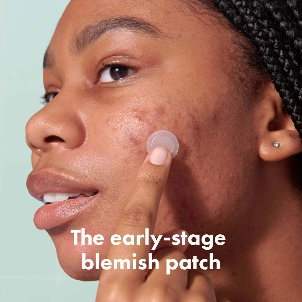 Mighty Patch Micropoint Large patch applied to a blemish for targeted spot treatment
