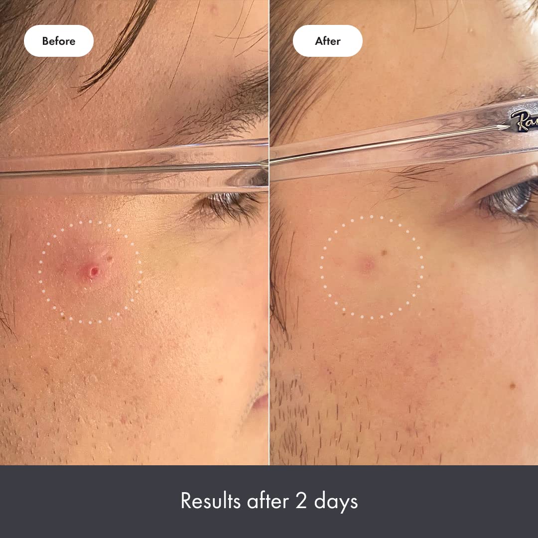 Mighty Patch Rescue Balm oligopeptides nourish and fortify post-blemish skin.