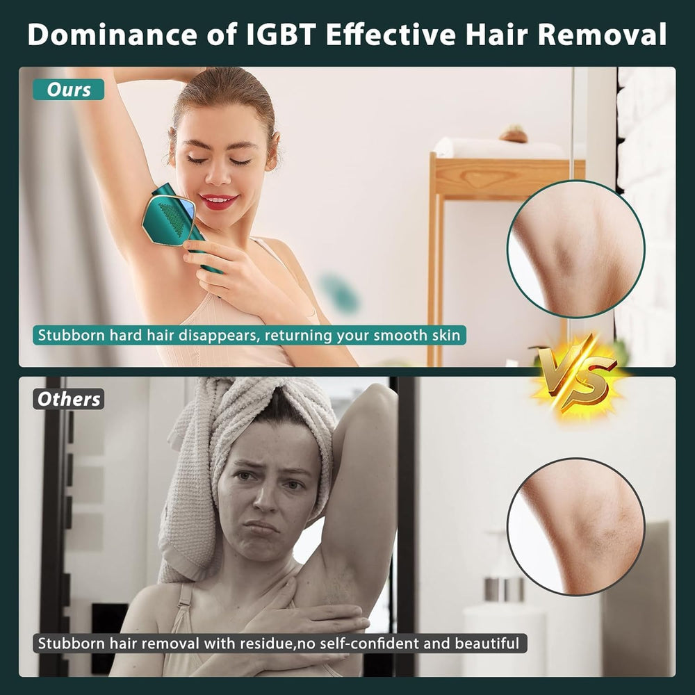 Mihilo laser removal bikini mode targets sensitive areas with safe, focused light.