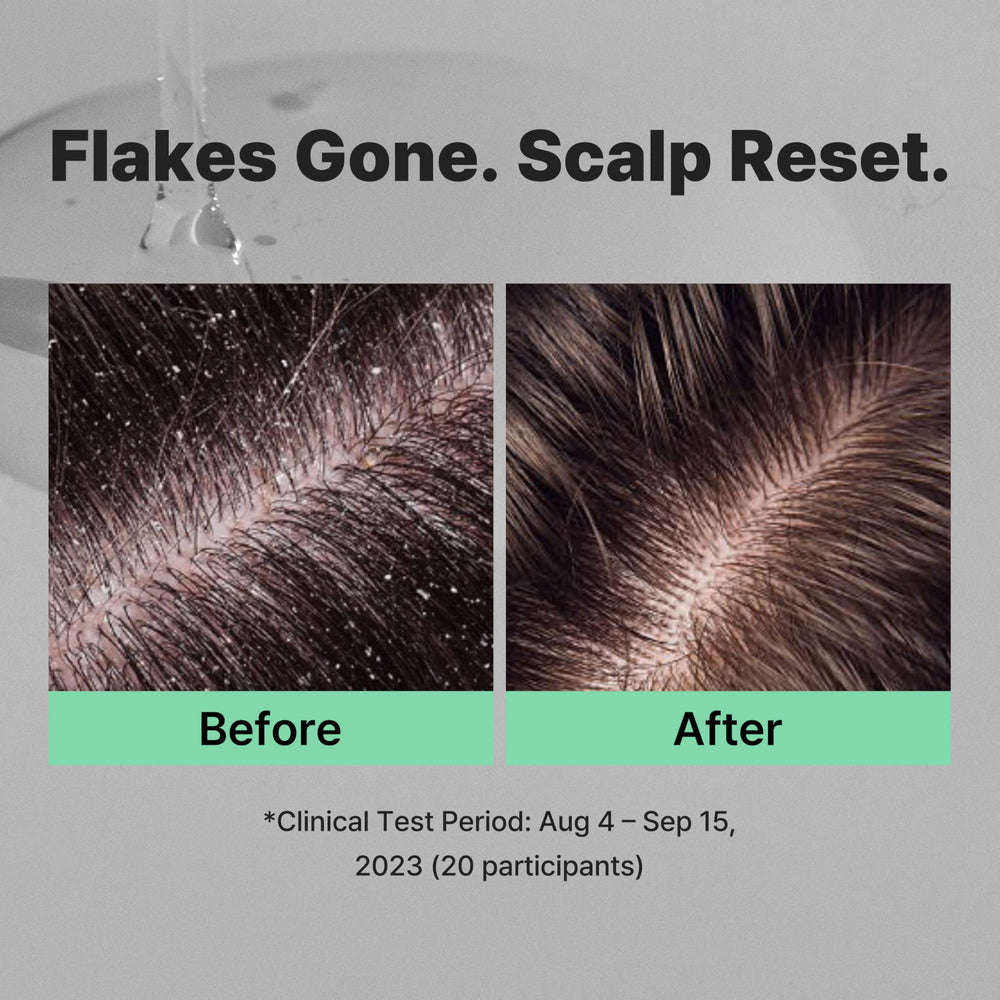 MINOXELL lather ready for deep cleansing of scalp