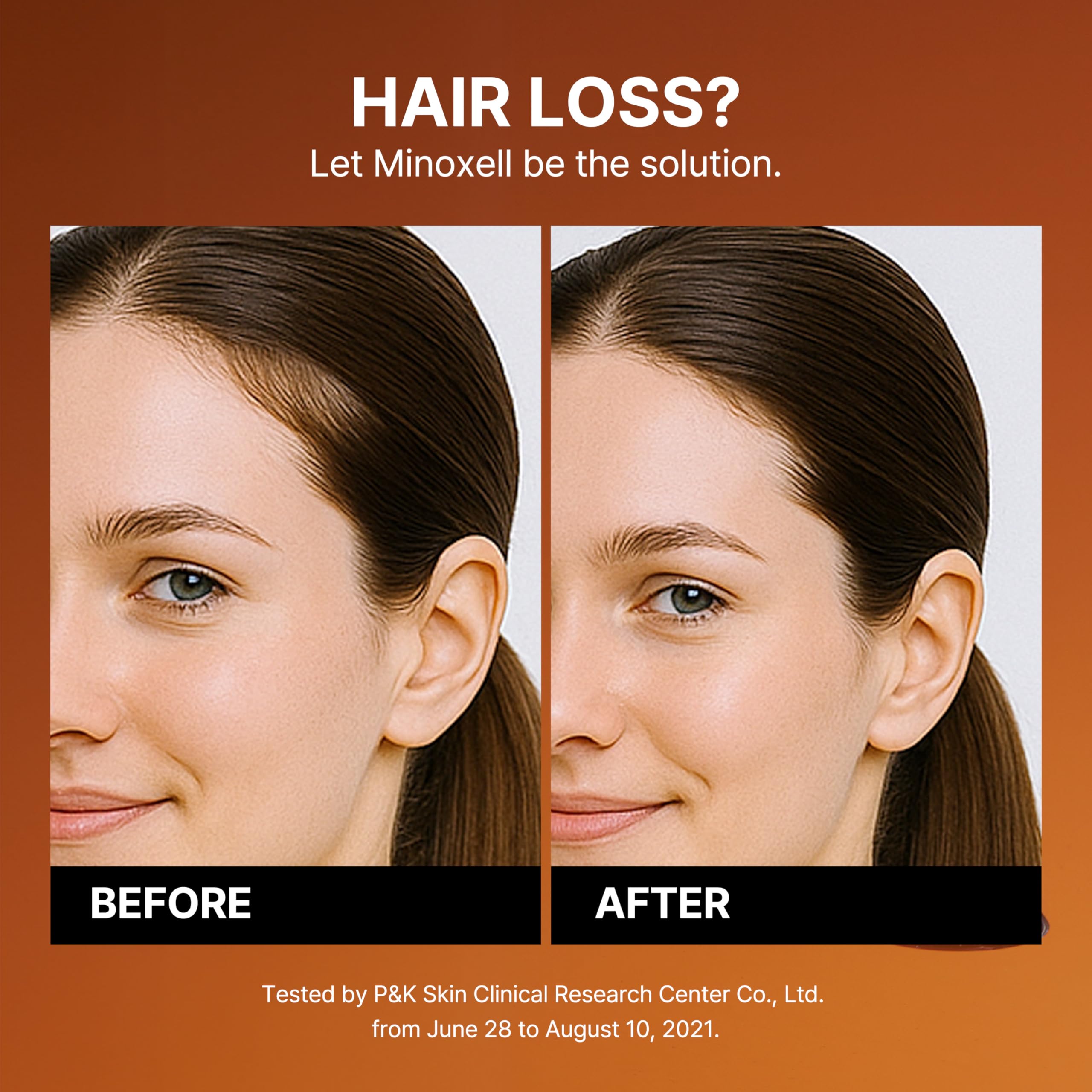 MINOXELL bottle shows panthenol and niacinamide for hair strength.