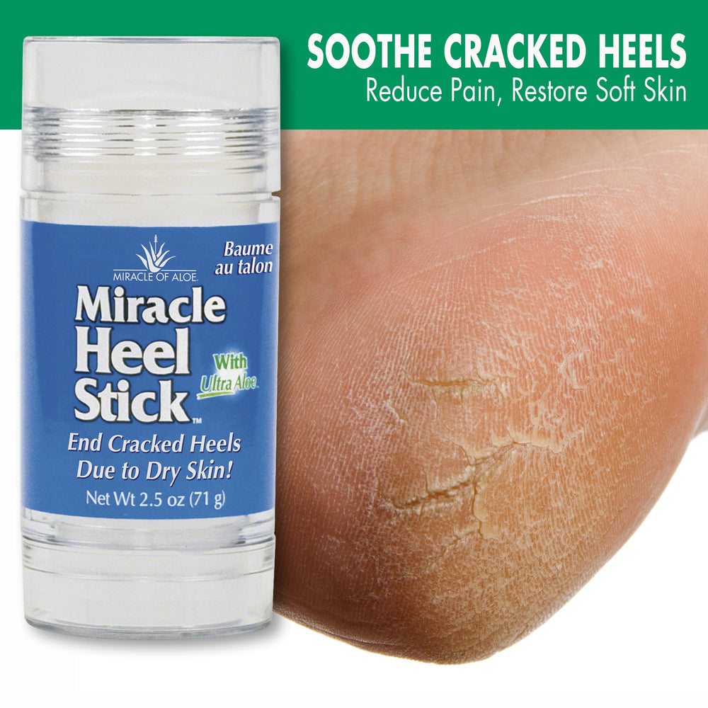 Cracked heel closeup by Miracle of Aloe highlighting deep moisture and texture