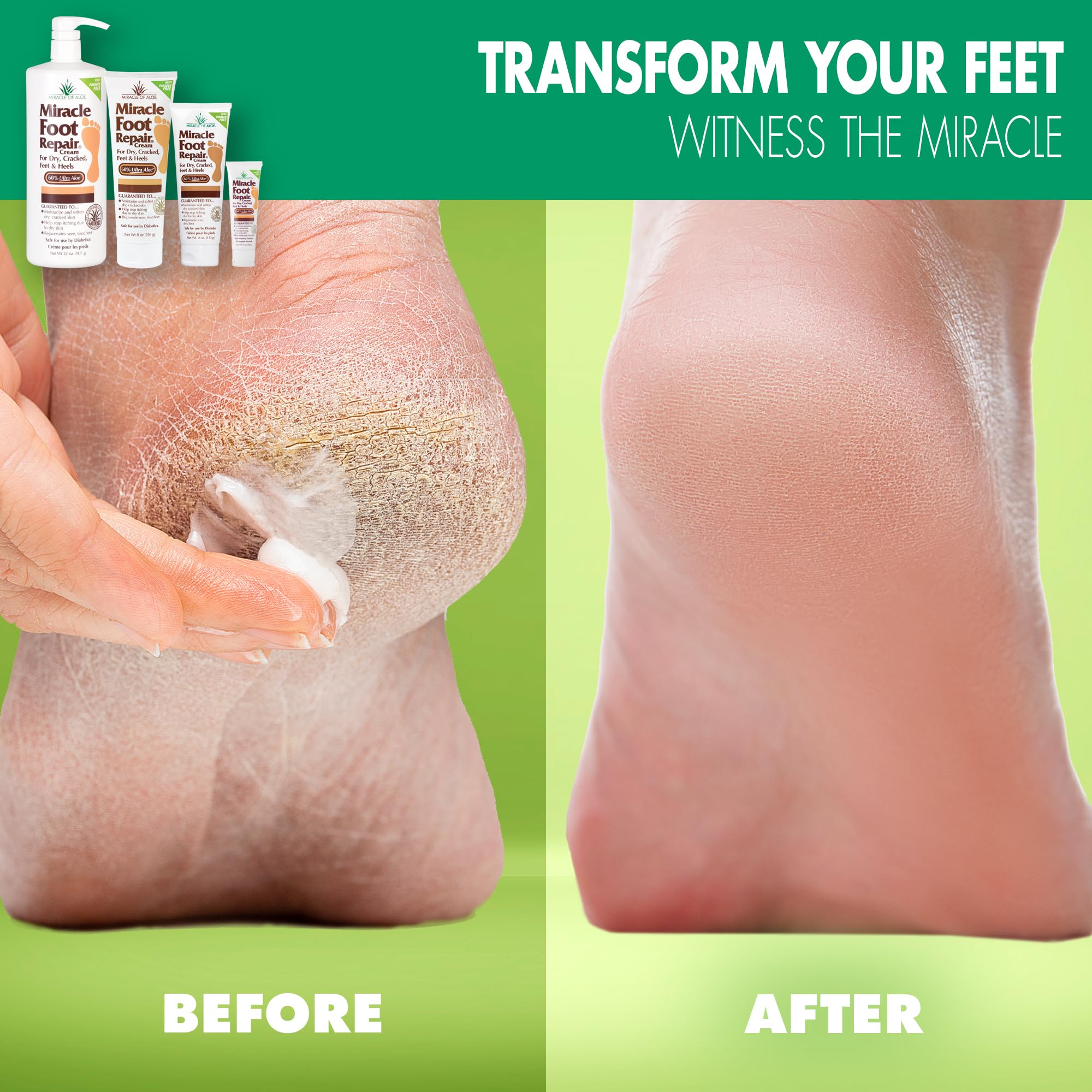 Miracle of Aloe Foot Repair Cream 1oz travel size ideal for on-the-go hydration