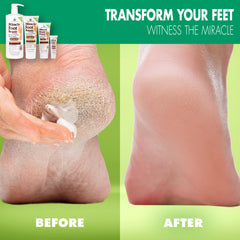 Miracle of Aloe Foot Repair Cream 1oz travel size ideal for on-the-go hydration