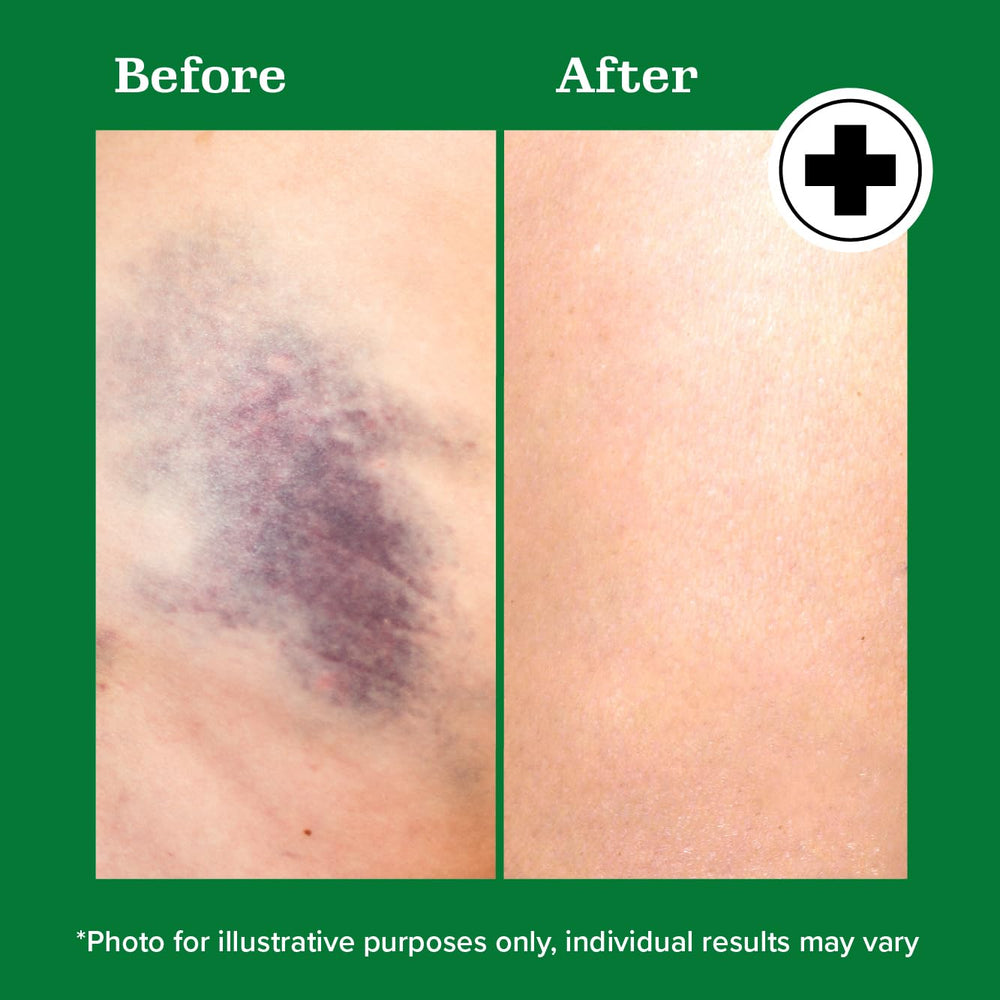 Gel absorbs quickly with Miracle Plus formula on skin without greasiness.