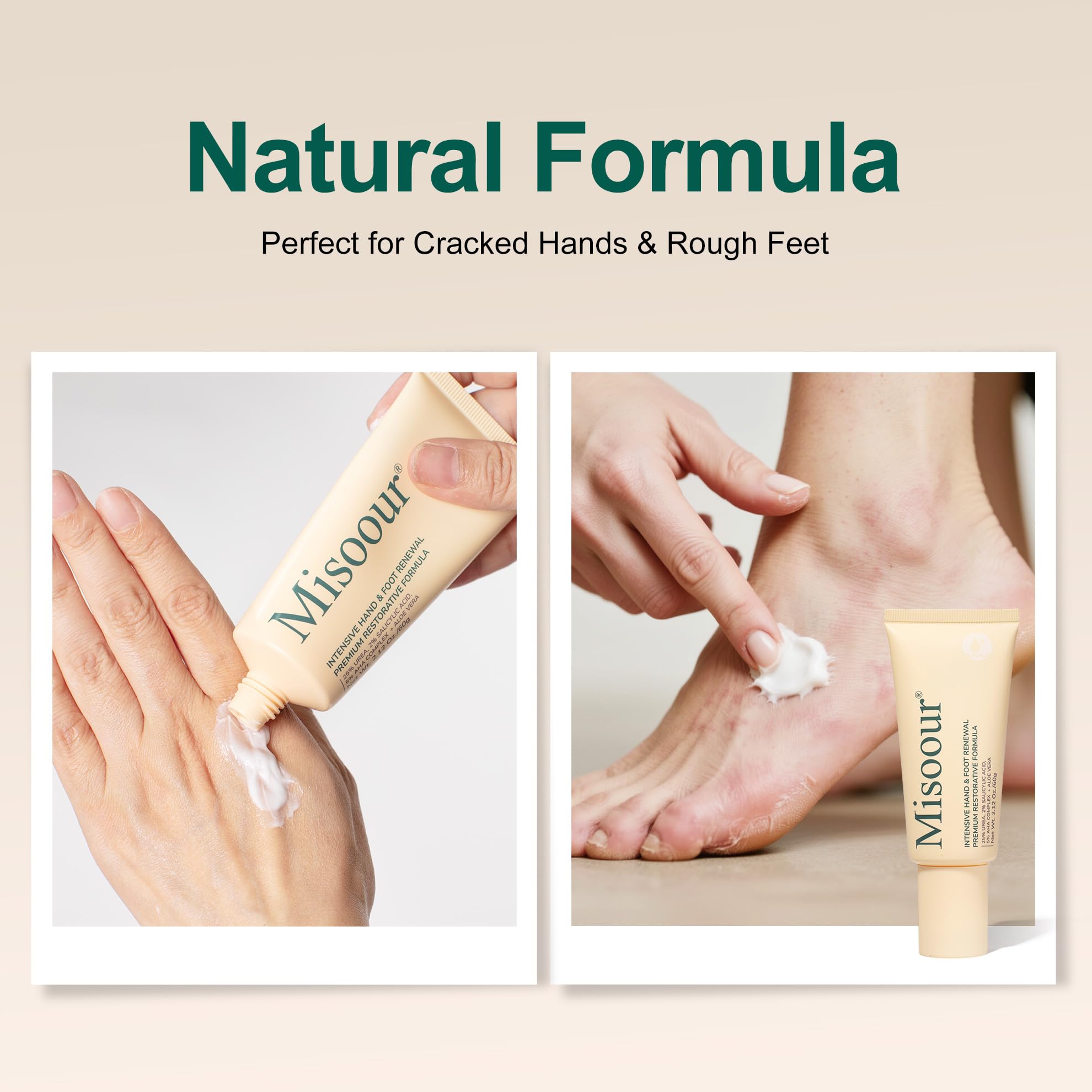 Misoour cream on elbow area signaling comfort and care