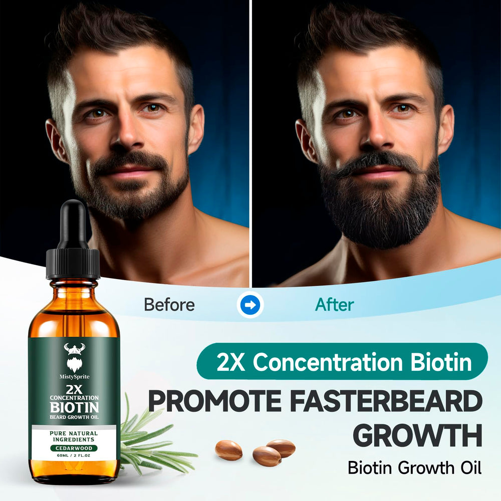 Mistysprite biotin-rich beard oil bottle highlighting growth support and stronger roots