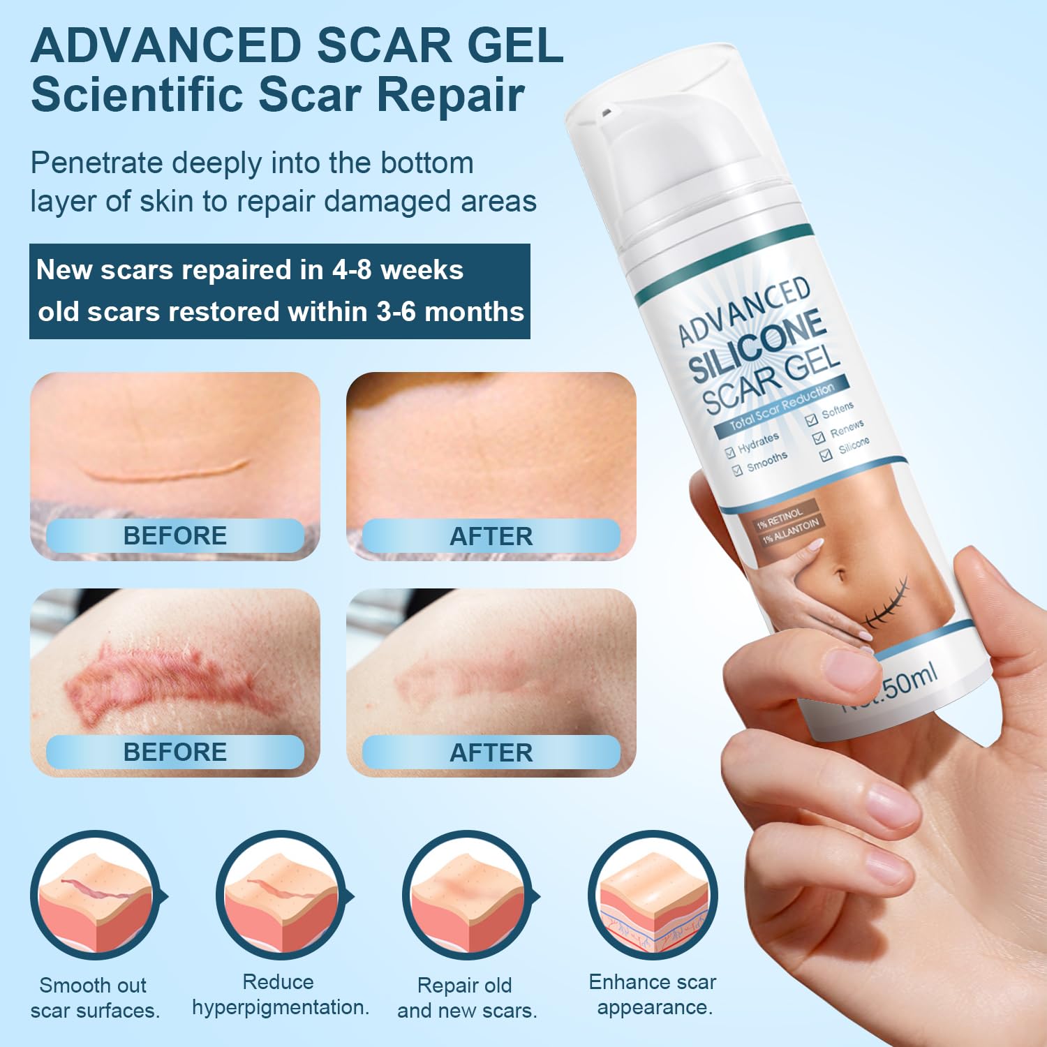 Mitgary Advanced Scar Gel targets new scars with potential improvements in color and texture.