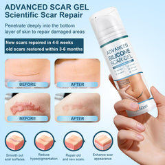 Mitgary Advanced Scar Gel targets new scars with potential improvements in color and texture.