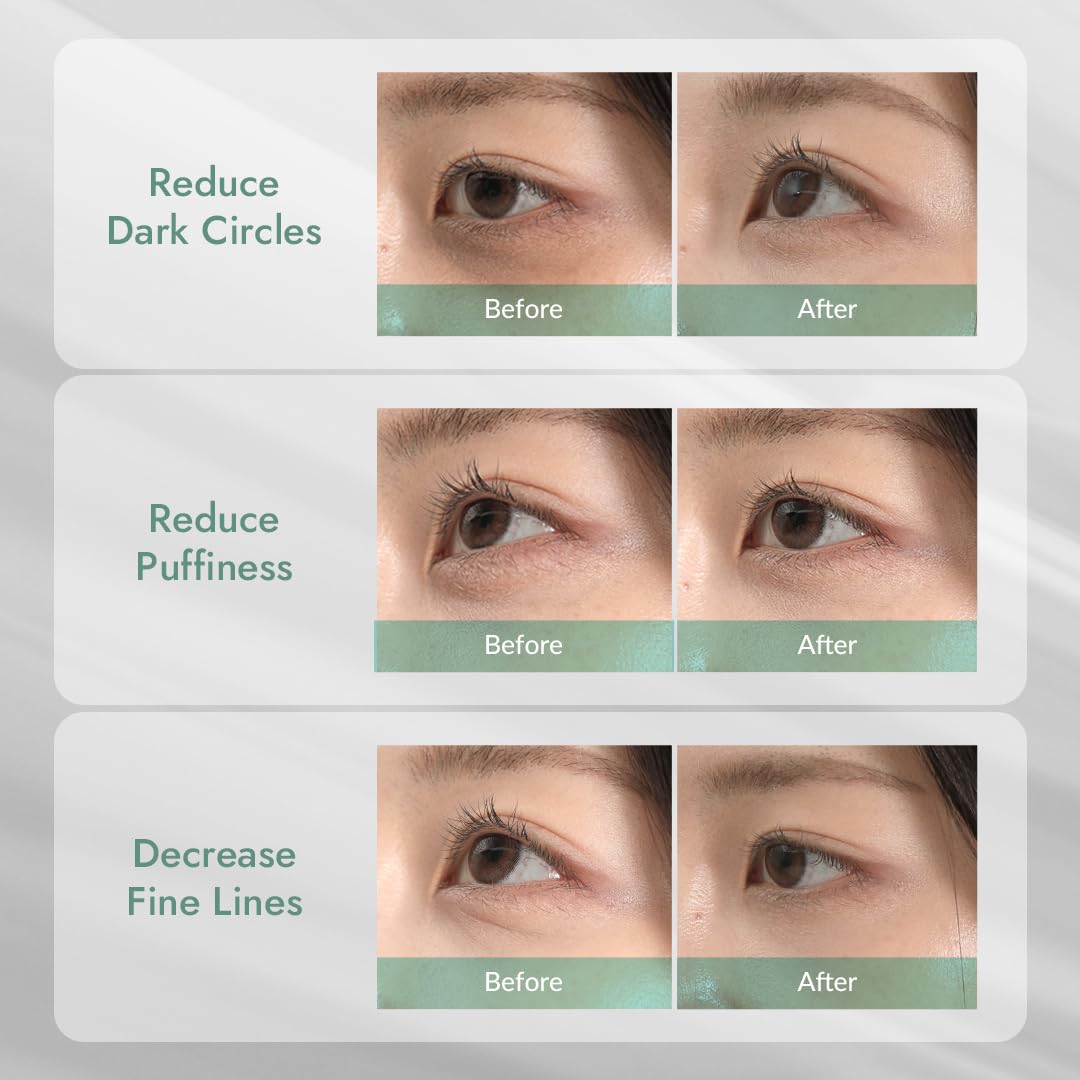 MIZON 24K gold peptide eye patch helps smooth fine lines around eyes.