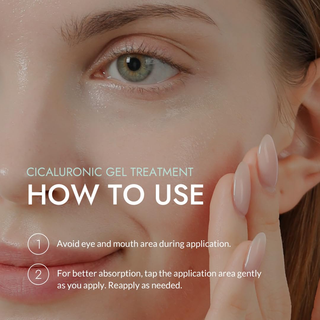 MIZON Cicaluronic gel on gentle skin, calm and refreshed.