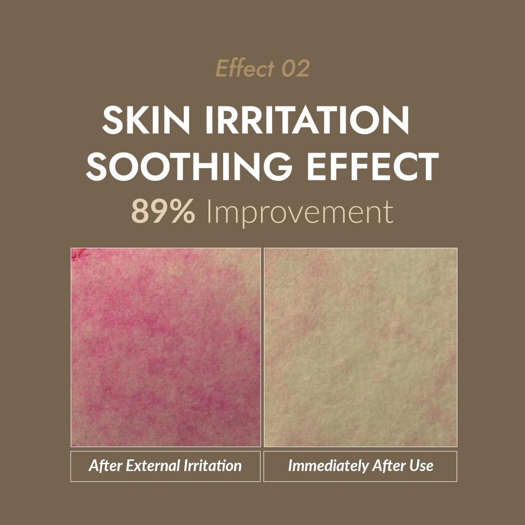 MIZON skin texture improvement concept shows a smoother appearance.