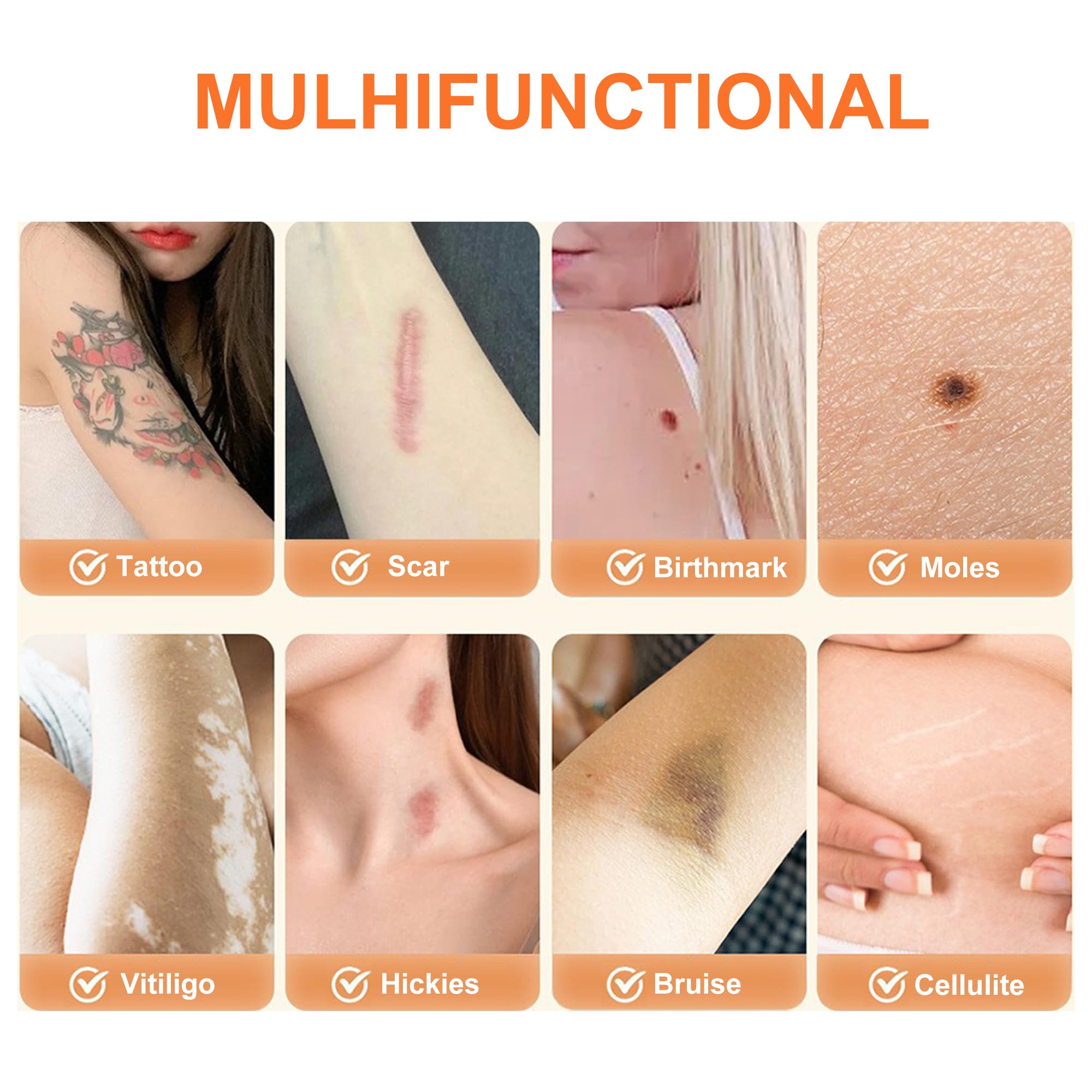 MlanRomee versatile use patch conceals birthmarks, scars, or blemishes discreetly.