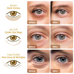 MLDWYH Rose Eye Mask soothing eye contour with gentle hydration