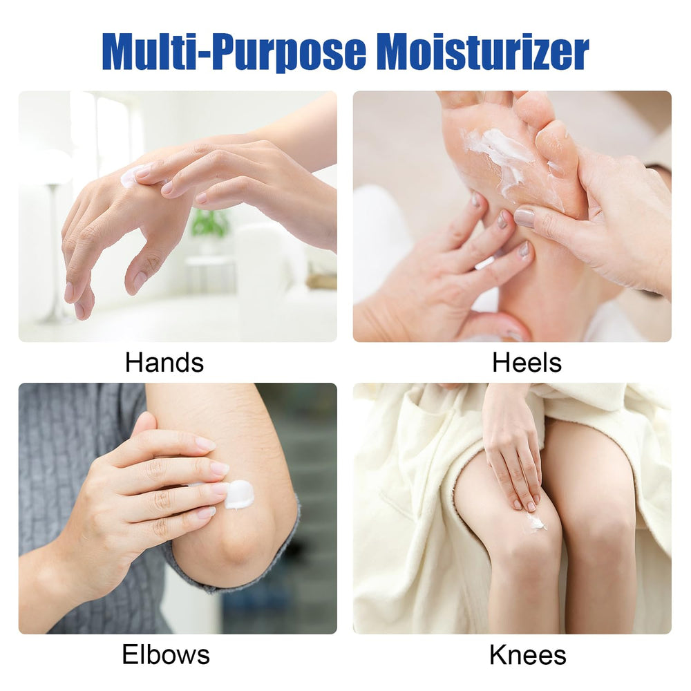 MOC LINK Urea Cream applied to hands for soft skin.