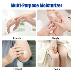 MOC LINK Urea Cream applied to hands for soft skin.