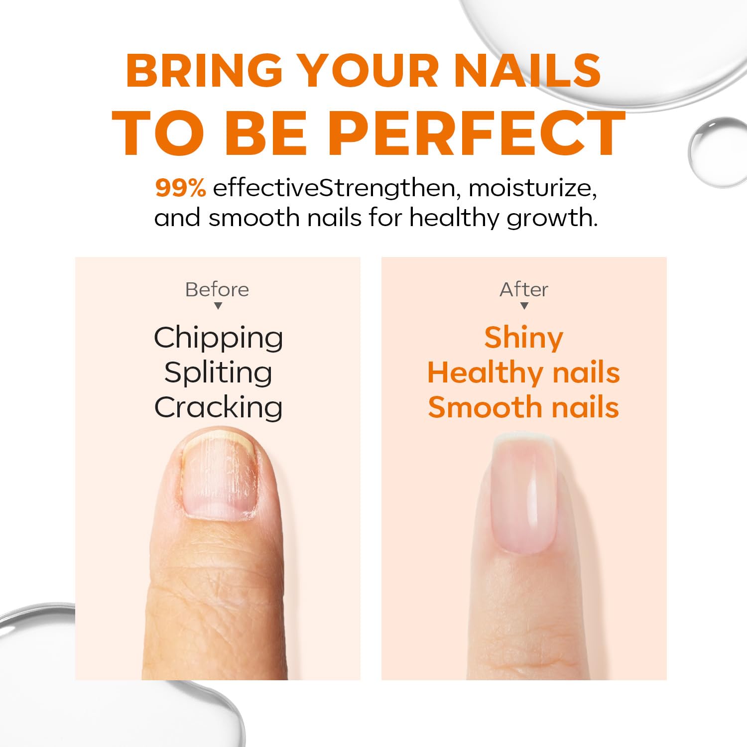 modelones damaged nails close-up highlights ridge filling for healthier look.